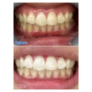 MBEAUTYSALON 千葉店・京成大久保所属・Melty 輝のその他イメージ