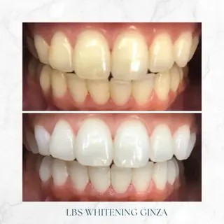 メンズ LBSホワイトニング 銀座店💎公式のその他イメージ