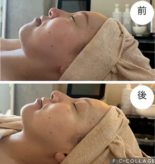 MiEL  total beaty salon所属・肌質改善サロン ナツコのエステ・リラクイメージ