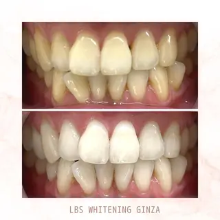 メンズ LBSホワイトニング 銀座店💎店長浦和のその他イメージ