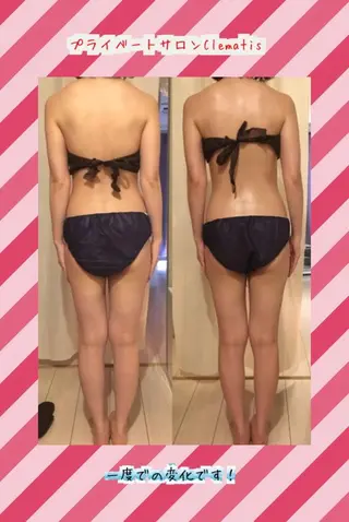 ロング カラー パーマ ヘアアレンジ メンズ キッズ ネイル マツエク・マツパ 強圧オールハンド痩身&黄土よもぎ蒸しプライベートサロンClematis池袋所属・強圧オールハンド痩身 片野のエステ・リラクイメージ