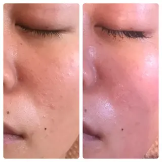 フェアリーローズ所属・fairyrose organicエステのエステ・リラクイメージ