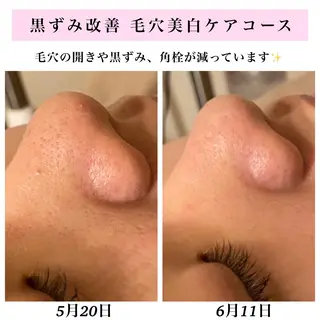 Bellesthe (ベルエステ)のエステ・リラクイメージ