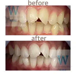 ホワイトニング ショップ船橋店のエステ・リラクイメージ