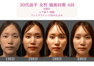 美容とカラダの鍼灸 サロン やなけんのエステ・リラクイメージ