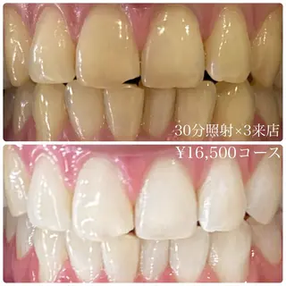 メンズ ホワイトニングルーム　川崎店所属・ホワイトニング ルーム　川崎店のその他イメージ