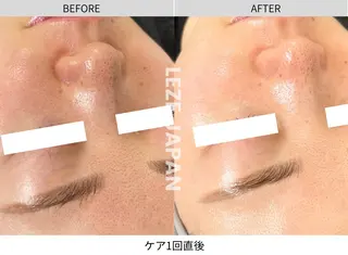 LA CLARTE所属・LA CLARTEのエステ・リラクイメージ