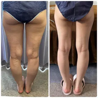 FLEUR大阪・整体 ・ハイフ・痩身・小顔のエステ・リラクイメージ