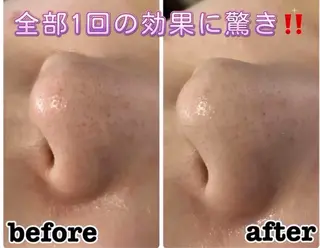 Salon Nicoli所属・歯科衛生士セラピスト MAKOのエステ・リラクイメージ