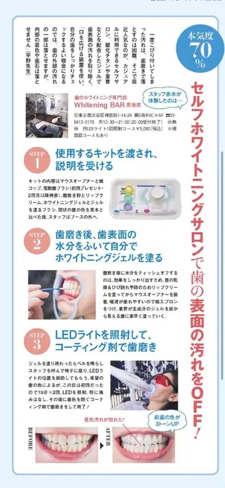 ホワイトニングバー 新潟店のその他イメージ