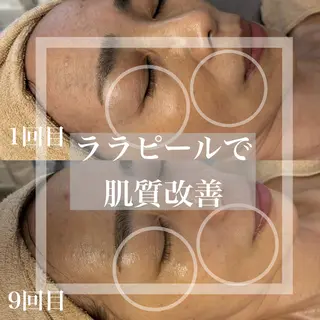 WHITE AQUA 北千住店のエステ・リラクイメージ