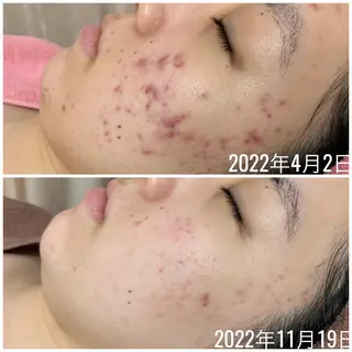 透明感の肌Lino malieのエステ・リラクイメージ