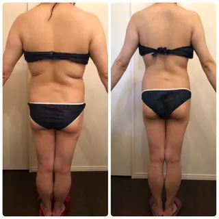 FLEUR大阪・美容 整体・痩身・小顔のエステ・リラクイメージ