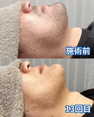 メンズ メンズ脱毛専門店Oceans所属・メンズ眉毛・脱毛専門 Oceansの眉毛・アイブロウイメージ