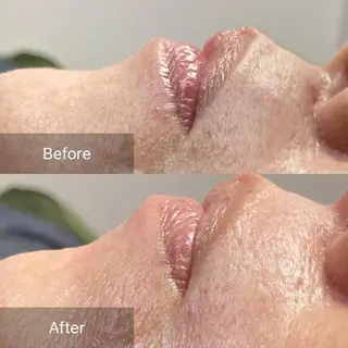 産毛専門店 Bittoのエステ・リラクイメージ