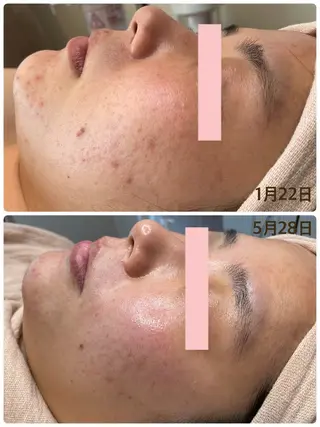 mihan beauteのエステ・リラクイメージ