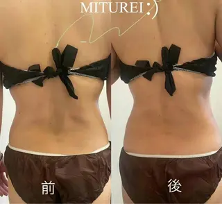 西区九条エステ MITUREIサロンのエステ・リラクイメージ