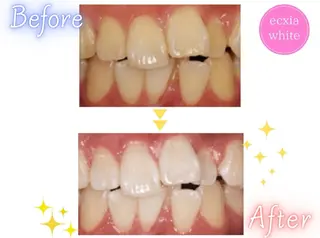 エクシアホワイト エミフルMASAKIのその他イメージ