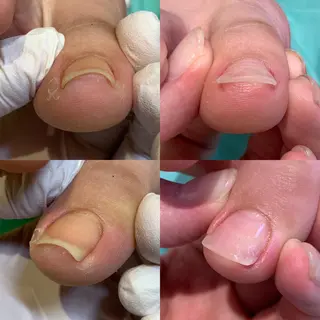 ネイル 東京巻き爪アカデミー所属・東京巻き爪 アカデミーのエステ・リラクイメージ