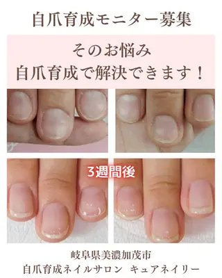 ネイル 木村 優華のネイルデザイン