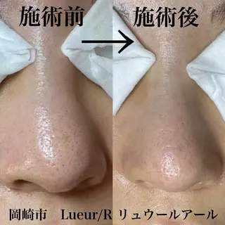 大久保 里奈のエステ・リラクイメージ