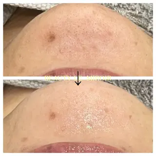 ビューティー ミロワールのエステ・リラクイメージ