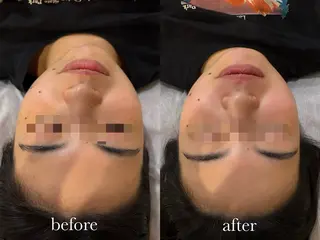 ENNE🦩小顔整体 師🌿 HINAKOのエステ・リラクイメージ