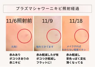 アイラッシュ&エステサロンLinda西宮所属・小顔&毛穴・肌質改善 LINDA西宮 AIのエステ・リラクイメージ