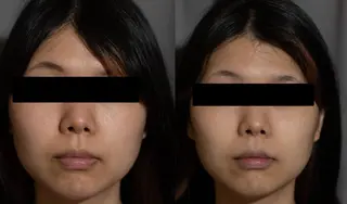 中山 秀展のエステ・リラクイメージ