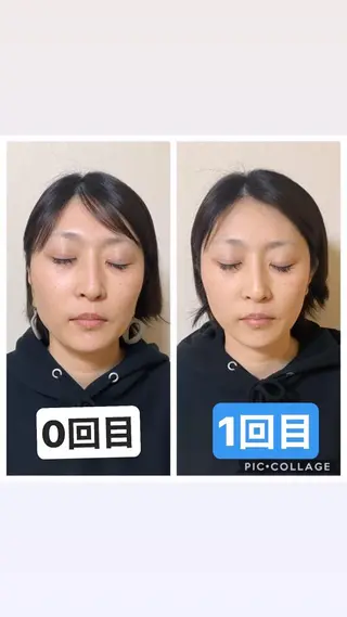 インタークロス所属・小顔矯正専門TIAM インタークロス池袋店のエステ・リラクイメージ