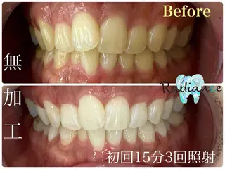 札幌ホワイトニング ラディアンス札幌駅店のその他イメージ