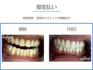 セルフホワイトニング エクシア岡崎店所属・ホワイトニング/脱毛 専門店エクシア岡崎店のその他イメージ
