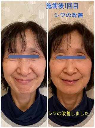 Anne’s happyBonesのエステ・リラクイメージ