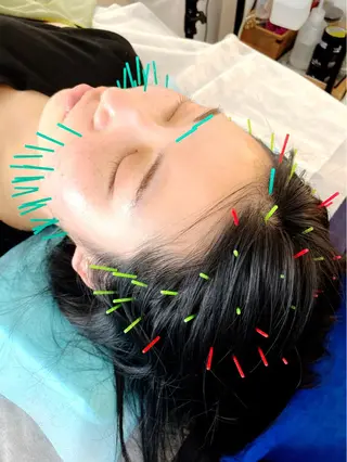 小顔美容鍼専門サロン 渋谷YZのエステ・リラクイメージ