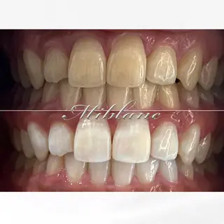 ホワイトニング MIBLANC上野店のその他イメージ