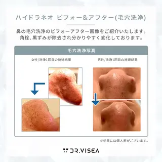 肌質改善専門 ハーブ /毛穴洗浄 リエイトのエステ・リラクイメージ