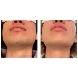 TotalBeautySalon UNCHEL所属・Ito ayakaのその他イメージ