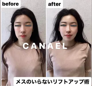 頭蓋骨から小さくする小顔&ヘッドスパ専門店 CANAEL所属・頭蓋骨から小さくする 小顔&ヘッドスパ専門のエステ・リラクイメージ