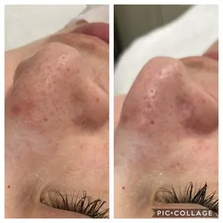 メンズ Ｂ&H所属・頭痛•肩こり専門/ 眉サロンB&H心斎橋のエステ・リラクイメージ