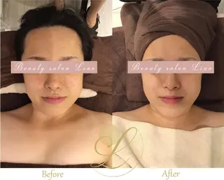 痩身×フェイシャル ブライダル|Linoのエステ・リラクイメージ