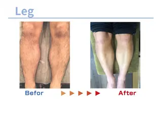 セルフ脱毛/美尻イス キングスサロン熊本のエステ・リラクイメージ