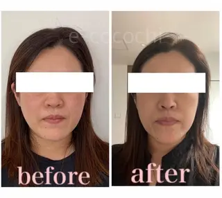 小顔と ヘッドスパのお店のエステ・リラクイメージ