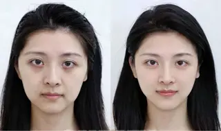 カラー aliaハイフ&水光ジェットサロン所属・aliaハーブ水光店 エステティシャン募集のエステ・リラクイメージ