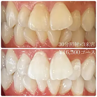 メンズ ホワイトニングルーム　川崎店所属・ホワイトニング ルーム　川崎店のその他イメージ