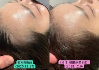 美容とカラダの鍼灸 サロン やなけんのエステ・リラクイメージ