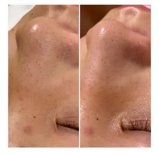 【頭痛、睡眠改善】 salon RUUのエステ・リラクイメージ