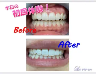 セルフホワイトニングサロン　ラヴィアン所属・ホワイトニングサロン La vie enのその他イメージ