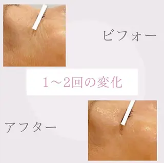 🎀BiBi韓国美容 コスパ強！美活サロンのエステ・リラクイメージ