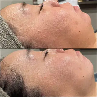 LiZA エステティックサロンのエステ・リラクイメージ