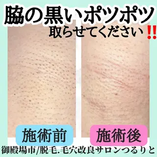 美肌脱毛サロン つるりと御殿場店所属・美肌脱毛サロン つるりとのその他イメージ